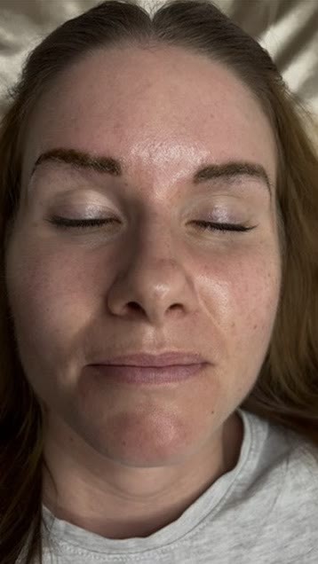Entfernung von Permanent Make-up, eine Woche nach der ersten Sitzung