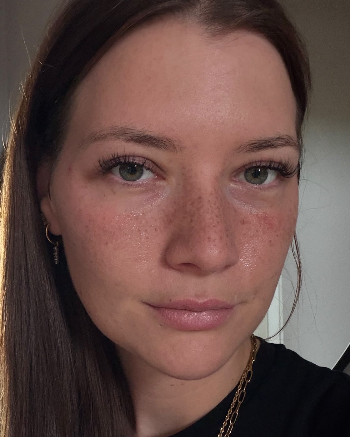 Fake Freckles, Ergebnis bei einem Content-Modell